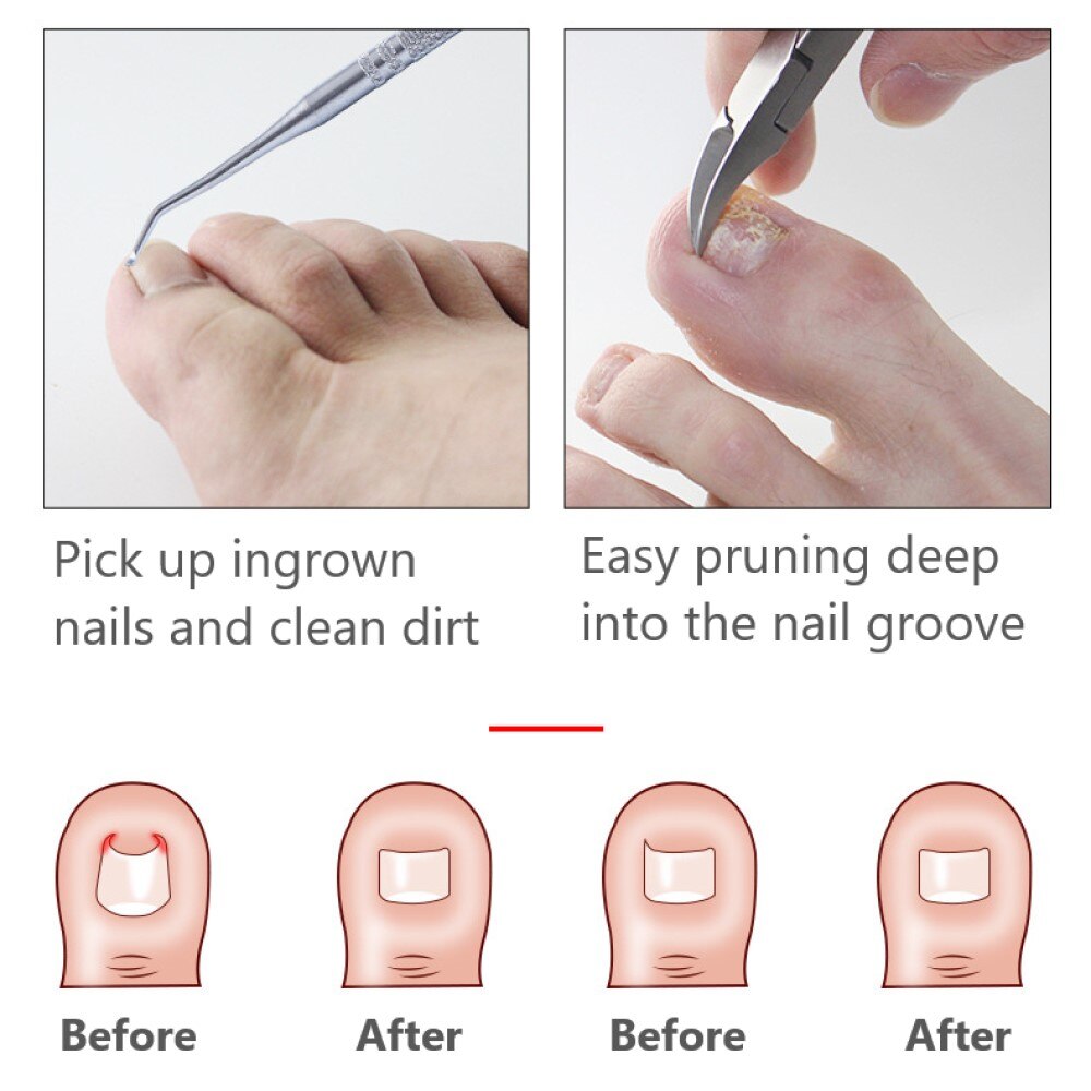 Dead Skin Dirt Remover Pedicure Care Tool