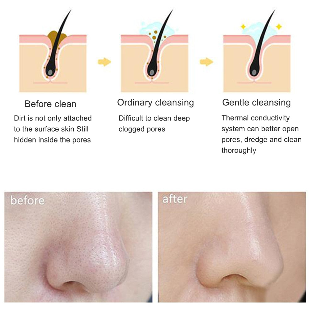 Electric cleanser Facial Cleansing Brush Face Skin Care Tools